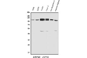 Western blot analysis of USP16 using anti-USP16 antibody (ABIN7602640). (USP16 Antikörper  (AA 9-823))