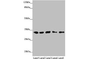 MMACHC antibody  (AA 63-282)