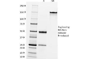 SDS-PAGE Analysis Purified CD10 Mouse Monoclonal Antibody (FR4D11). (MME Antikörper)