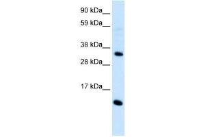 CCL18 antibody (70R-10507) used at 0.