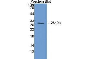 Detection of Recombinant TFR, Pig using Polyclonal Antibody to Transferrin Receptor (TFR) (Transferrin Receptor Antikörper  (AA 578-765))