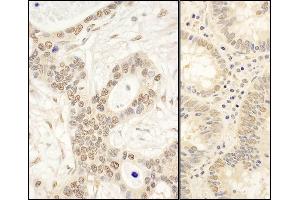 Immunohistochemistry (IHC) image for anti-Fas (TNFRSF6) Associated Factor 1 (FAF1) (AA 25-75) antibody (ABIN7453705)