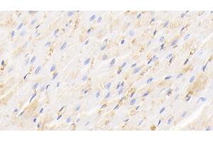 Immunohistochemistry (IHC) image for anti-Hemoglobin antibody (ABIN7437236)