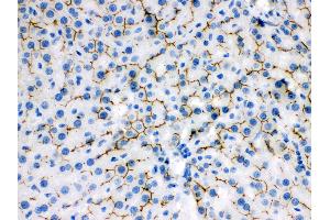 Anti- ABCB11 Picoband antibody, IHC(P) IHC(P): Rat Liver Tissue (ABCB11 Antikörper  (C-Term))
