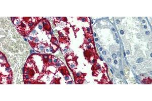 Immunohistochemistry (IHC) image for anti-Glucose 6-Phosphatase, Catalytic (G6PC) (N-Term) antibody (ABIN2781770)