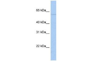 WB Suggested Anti-PAPD4 Antibody Titration:  0. (PAPD4 Antikörper  (N-Term))