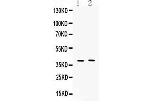 Western blot analysis of MC3 Receptor expression in mouse kidney extract ( Lane 1), and COLO320 whole cell lysates ( Lane 2). (MC3R Antikörper  (N-Term))