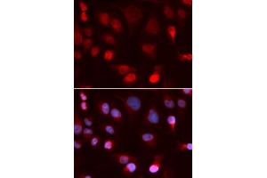 Immunofluorescence analysis of U2OS cells using ATP7B antibody. (ATP7B Antikörper)