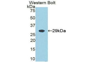 Western Blotting (WB) image for anti-Growth Factor Receptor-Bound Protein 2 (GRB2) (AA 1-217) antibody (ABIN1859065) (GRB2 Antikörper  (AA 1-217))