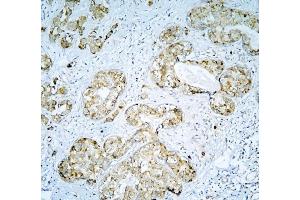 IHC analysis of DARS2 using anti-DARS2 antibody (ABIN6719279). (DARS2 Antikörper  (AA 334-448))