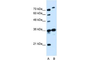 WB Suggested Anti-SLC9A7 Antibody Titration:  0.