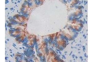 Immunohistochemistry (IHC) image for anti-Eosinophil Cationic Protein (ECP) (AA 33-155) antibody (ABIN7441835)
