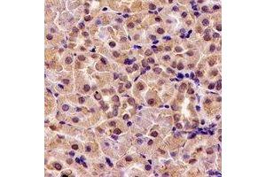 Immunohistochemical analysis of HS1BP3 staining in rat kidney formalin fixed paraffin embedded tissue section. (HS1BP3 Antikörper)