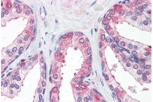 Human Prostate (formalin-fixed, paraffin-embedded) stained with CLDN5 antibody ABIN364455 at 15 ug/ml followed by biotinylated goat anti-rabbit IgG secondary antibody ABIN481713, alkaline phosphatase-streptavidin and chromogen. (Claudin 5 Antikörper  (C-Term))