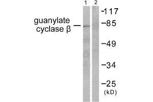 Western Blotting (WB) image for anti-Guanylate Cyclase, beta (GUCYB) (N-Term) antibody (ABIN1848590) (GUCYB Antikörper  (N-Term))