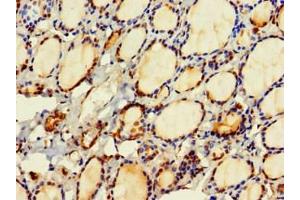 Immunohistochemistry of paraffin-embedded human thyroid tissue using ABIN7154818 at dilution of 1:100 (HDHD2 Antikörper  (AA 97-249))