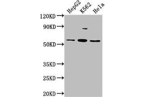 Western Blot Positive WB detected in: HepG2 whole cell lysate, K562 whole cell lysate, Hela whole cell lysate All lanes: ADRA1A antibody at 1:2000 Secondary Goat polyclonal to rabbit IgG at 1/50000 dilution Predicted band size: 52, 53, 48, 51, 33, 38, 36, 41 kDa Observed band size: 52 kDa (alpha 1 Adrenergic Receptor Antikörper  (AA 6-22))