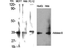 Western Blot (WB) analysis of specific cells using Aldolase B Polyclonal Antibody. (ALDOB Antikörper  (Internal Region))