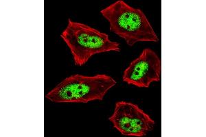 Fluorescent image of  cells stained with IL18 Antibody (C-term) . (IL-18 Antikörper  (C-Term))