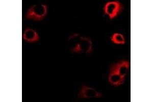 Immunofluorescent analysis of Kinesin 2 staining in SW480 cells. (KIF2A Antikörper)