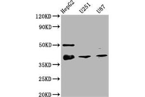 Western Blot Positive WB detected in: HepG2 whole cell lysate, U251 whole cell lysate, U87 whole cell lysate All lanes: TTF1 antibody at 1:2000 Secondary Goat polyclonal to rabbit IgG at 1/50000 dilution Predicted band size: 39 kDa Observed band size: 39 kDa (Rekombinanter NKX2-1 Antikörper)