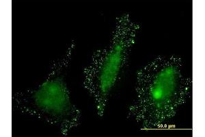 Immunofluorescence of monoclonal antibody to PKN2 on HeLa cell. (PKN2 Antikörper  (AA 580-679))