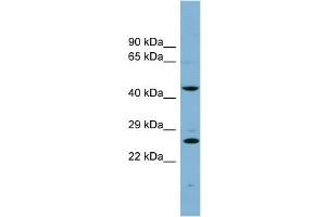 WB Suggested Anti-VPS28 Antibody Titration: 0. (VPS28 Antikörper  (N-Term))