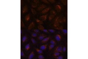 Immunofluorescence analysis of U-2 OS cells using  antibody (ABIN6131176, ABIN6136646, ABIN6136647 and ABIN6222857) at dilution of 1:100. (AGR2 Antikörper  (AA 21-175))