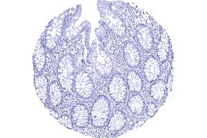 Complete absence of AR staining in normal colon mucosa (Rekombinanter Androgen Receptor Antikörper  (AA 1-100))