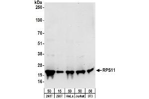 anti-Ribosomal Protein S11 (RPS11) (AA 108-158) antibody