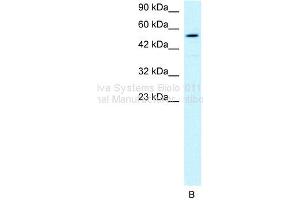 WB Suggested Anti-HLX1 Antibody Titration: 1ug/mlPositive Control: HepG2 cell lysate (HLX Antikörper  (Middle Region))