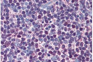 Human Thymus (formalin-fixed, paraffin-embedded) stained with CASP3 antibody ABIN305732 at 5 ug/ml followed by biotinylated anti-mouse IgG secondary antibody ABIN481714, alkaline phosphatase-streptavidin and chromogen. (Caspase 3 Antikörper)