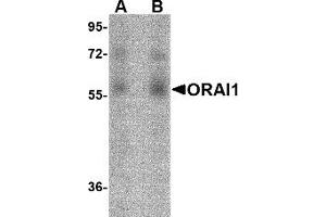 Western Blotting (WB) image for anti-ORAI Calcium Release-Activated Calcium Modulator 1 (ORAI1) antibody (ABIN1031711)
