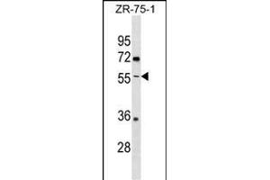 ENTPD5 Antibody (C-term) (ABIN1537153 and ABIN2838297) western blot analysis in ZR-75-1 cell line lysates (35 μg/lane). (ENTPD5 Antikörper  (C-Term))