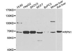 Western blot analysis of extracts of various cell lines, using RPN1 antibody. (RPN1 Antikörper  (AA 20-280))