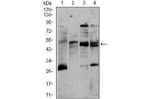 Western blot analysis using CD5 mouse mAb against K562 (1), Jurkat (2), Raji (3), and MOLT4 (4) cell lysate.
