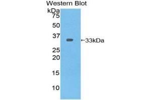 Western blot analysis of the recombinant protein. (PLEKHA1 Antikörper  (AA 92-346))