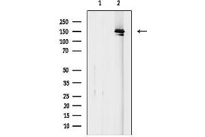 anti-Apoptotic Chromatin Condensation Inducer 1 (ACIN1) (Internal Region) antibody