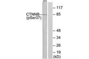 Western blot analysis of extracts from 293 cells, using Catenin-beta (Phospho-Ser37) Antibody. (beta Catenin Antikörper  (pSer37))