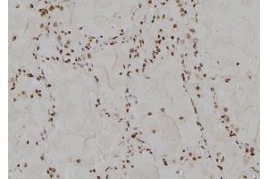 ABIN6275651 at 1/100 staining Human  tissue by IHC-P. (USP13 Antikörper  (C-Term))