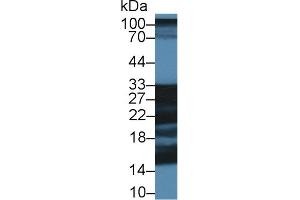 Western Blot; Sample: Porcine Cerebrum lysate; Primary Ab: 1µg/ml Rabbit Anti-Human SNAP25 Antibody Second Ab: 0. (SHISA4 Antikörper  (AA 28-197))