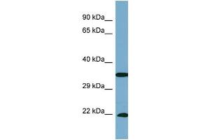 Host:  Rabbit  Target Name:  SLC6A6  Sample Type:  PANC1 Whole cell lysates  Antibody Dilution:  1. (TAUT Antikörper  (C-Term))