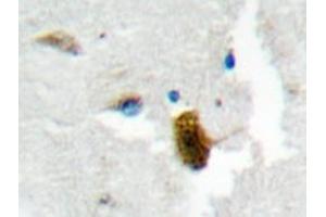 Immunohistochemistry analyzes of MgcRacGAP antibody in paraffin-embedded human brain tissue. (RACGAP1 Antikörper)