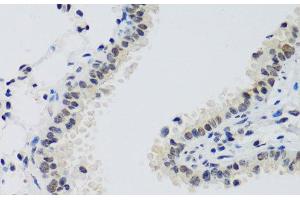 Immunohistochemistry of paraffin-embedded Mouse lung using CCNE2 Polyclonal Antibody at dilution of 1:100 (40x lens). (Cyclin E2 Antikörper)