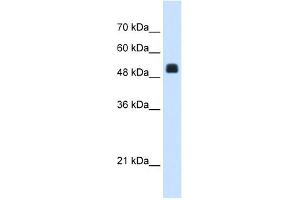 WB Suggested Anti-NAGS Antibody Titration:  1. (NAGS Antikörper  (C-Term))