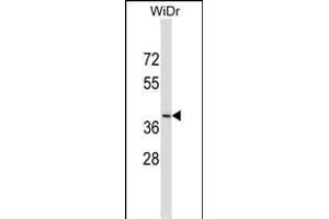 DUOXA2 Antibody (C-term) (ABIN657340 and ABIN2837918) western blot analysis in WiDr cell line lysates (35 μg/lane).