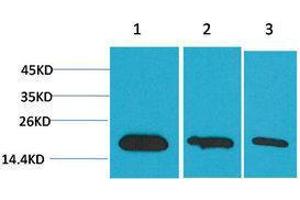 Western Blotting (WB) image for anti-Baculoviral IAP Repeat-Containing 5 (BIRC5) antibody (ABIN3179085) (Survivin Antikörper)