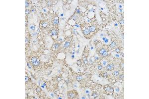 Immunohistochemistry (IHC) image for anti-Retinoic Acid Receptor Responder (Tazarotene Induced) 2 (RARRES2) (AA 17-163) antibody (ABIN6146704)