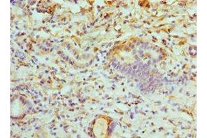 Immunohistochemistry (IHC) image for anti-ATPase, H+ Transporting, Lysosomal 56/58kDa, V1 Subunit B1 (ATP6V1B1) (AA 1-280) antibody (ABIN7175230)