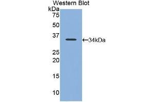 Detection of Recombinant NB1, Mouse using Polyclonal Antibody to Neutrophil Specific Antigen 1 (NB1) (CD177 Antikörper  (AA 193-468))